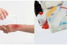 Công nghệ in phun làm lành vết thương nhanh chóng