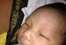 Đèn flash có thể gây mù mắt trẻ sơ sinh hay không?