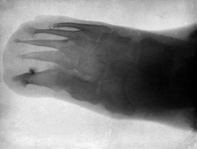 Tấm ảnh X-quang đầu tiên đã khiến vợ nhà phát minh ra nó phải giật mình