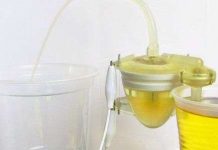 Robot sinh học chạy bằng năng lượng từ nước tiểu Robot sinh học chạy bằng năng lượng từ nước tiểu