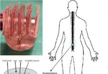 Chip giúp người liệt cử động