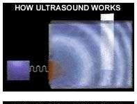 Máy quét 'nhìn xuyên' bê tông