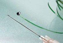 Nội soi với camera siêu nhỏ