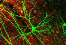 Nơron nhân tạo thay thế dây thần kinh trong não người