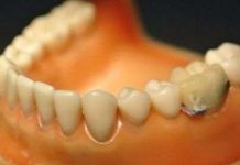 Theo dõi hoạt động răng miệng bằng bluetooth