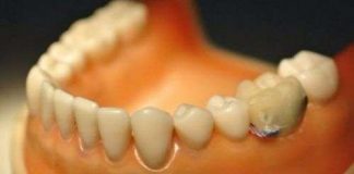 Theo dõi hoạt động răng miệng bằng bluetooth