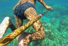 Những đứa trẻ kỳ lạ có "đôi mắt của cá heo"