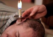 Không phải tăm bông, người ta còn có thể lấy ráy tai bằng nến