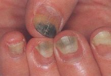 Sự thật bất ngờ ẩn giấu dưới chiếc móng tay của bạn