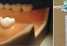 Cảm biến răng giúp bỏ thói quen xấu