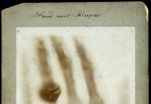 Tấm ảnh X-quang đầu tiên đã khiến vợ nhà phát minh ra nó phải giật mình