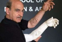 Cấy tai nhân tạo lên cánh tay để tạo ra một thiết bị nghe công cộng