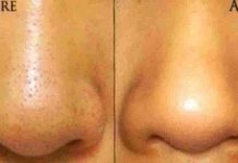 Những công dụng của baking soda khiến bạn phải ngạc nhiên