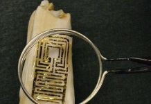 Cảm biến điện tử siêu nhỏ trên răng chẩn đoán bệnh