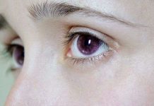 Truyền thuyết li kì về những người có đôi mắt tím