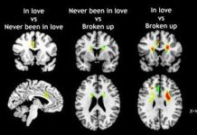Chụp não có thể chỉ ra người đang yêu