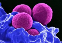 Bí ẩn đằng sau việc phóng siêu khuẩn chết người vào không gian Bí ẩn đằng sau việc phóng siêu khuẩn chết người vào không gian