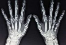 Tia X mới nhìn xuyên thấu