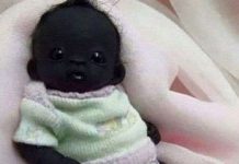 Sự thật gây sốc về "em bé Nam Phi đen nhất thế giới"