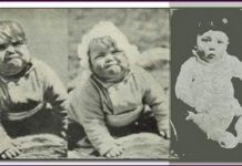 “Myc” và “Ras” – gen phòng ung thư của tế bào Những trò lừa bịp hay ho nhất thế kỷ