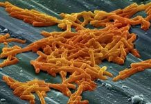 Phát hiện nguyên nhân siêu vi khuẩn kháng thuốc