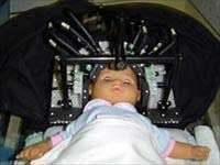 Máy quét não cầm tay giúp cứu chữa trẻ sơ sinh