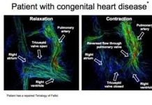 Công nghệ chụp ảnh tim 4D