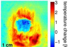 Laser làm lạnh hoặc tạo ra trạng thái vật thể kỳ lạ