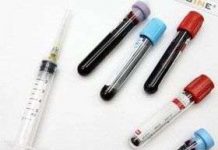 Chip phát hiện nhiều bệnh chỉ trong một giọt máu Chip phát hiện nhiều bệnh chỉ trong một giọt máu