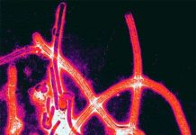 10 loại virus nguy hiểm nhất hành tinh