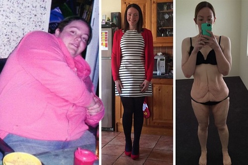 Người phụ nữ giảm 95 kg chỉ vì một lời chê